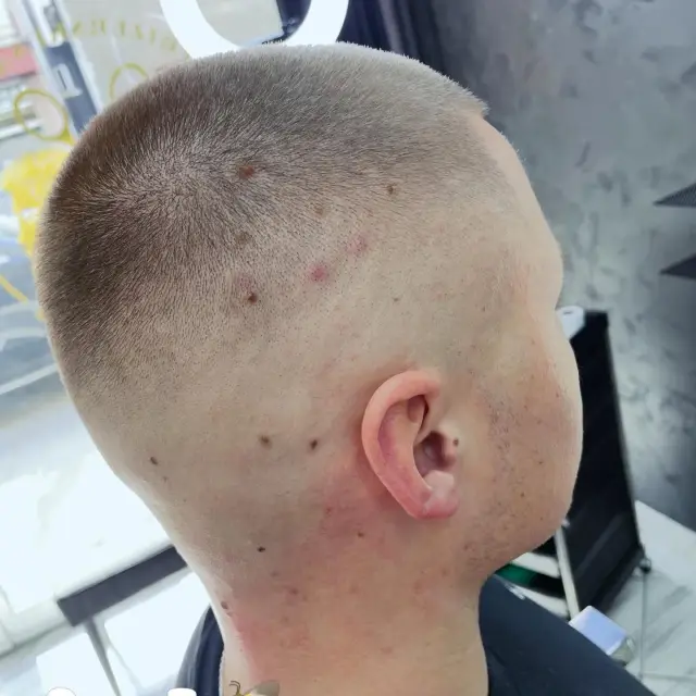 Fade šišanje sa visokim prelazom do kože
